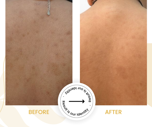 Healthier overall skin appearance