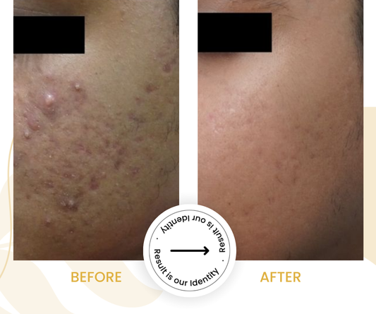 Reduced redness and inflammation