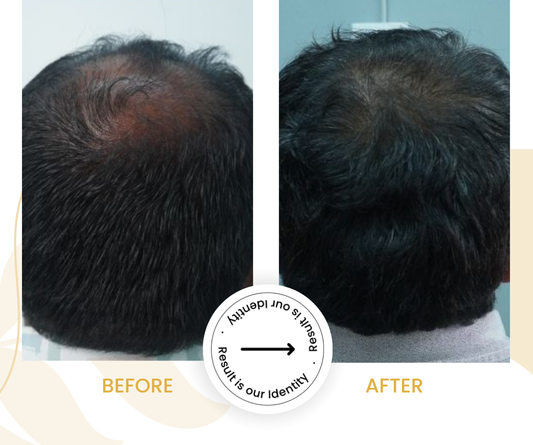 Esthe Advance Hair Therapy_2