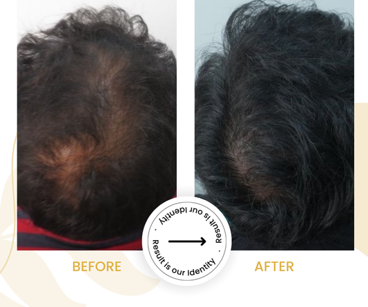 Stronger hair growth