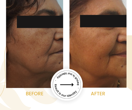 Healthier skin appearance