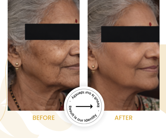 Smoother skin texture