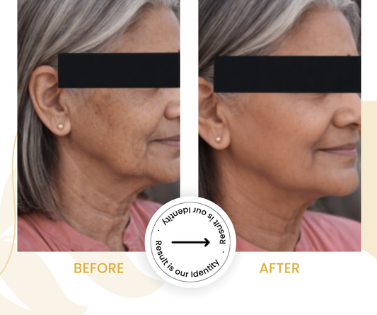 Reduced appearance of fine lines