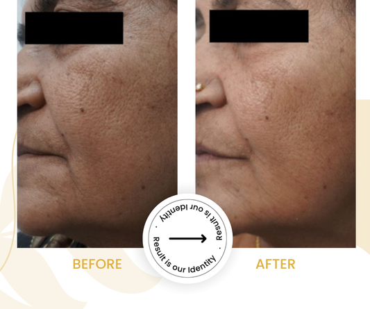 Improved skin firmness