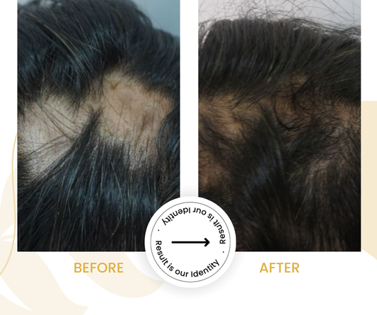Reduced bald patches