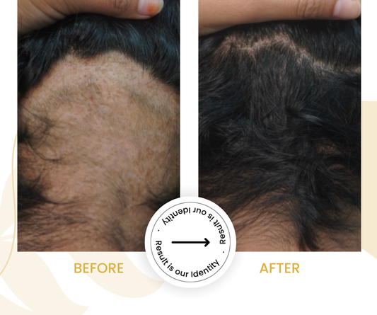 New hair growth in affected areas