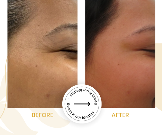 More refreshed appearance