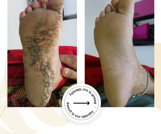 Healthier skin appearance