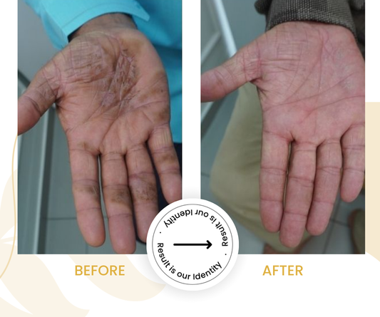 Improved skin texture