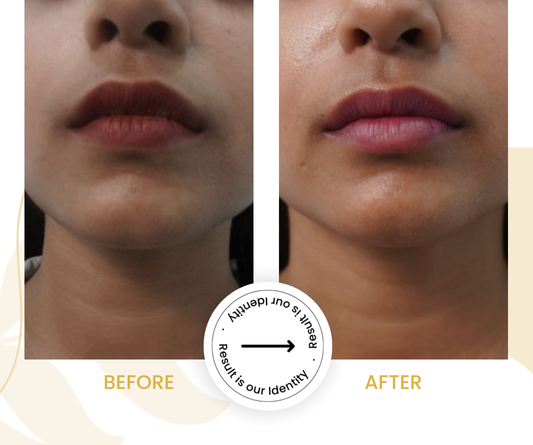 More radiant skin appearance