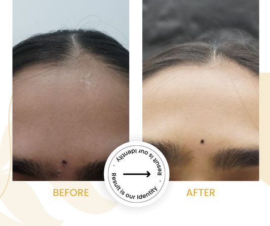 Improved skin brightness