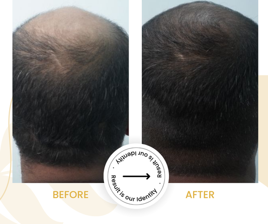 Stronger and thicker-looking hair