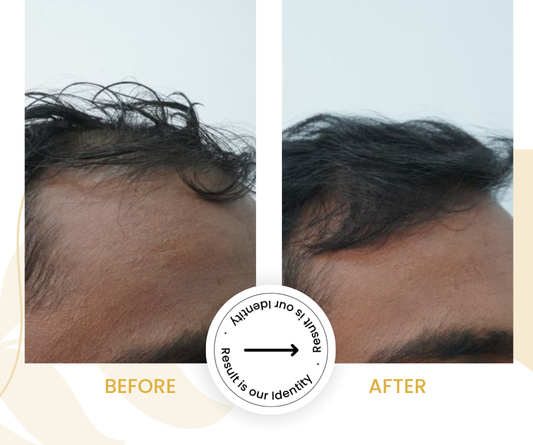 Healthier scalp condition