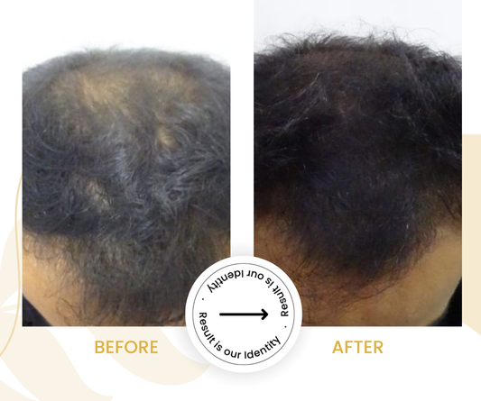 Reduced hair shedding