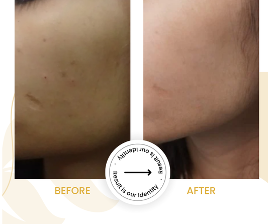 Improved skin brightness