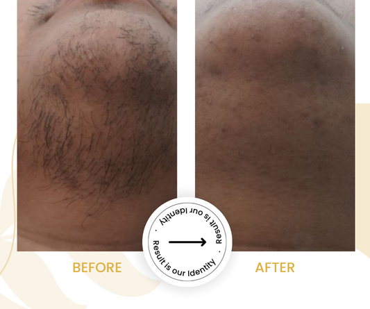 Reduced ingrown hair problems