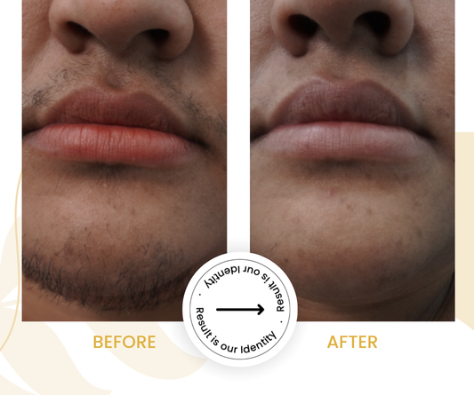 Smoother skin surface