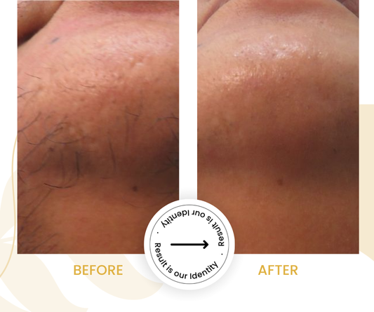 Improved skin appearance