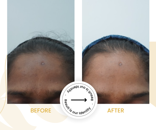 Healthier skin texture