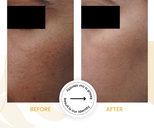 Brighter skin appearance