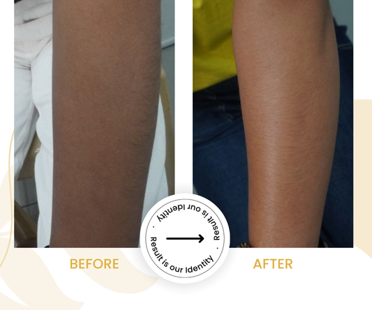 Improved skin tone uniformity