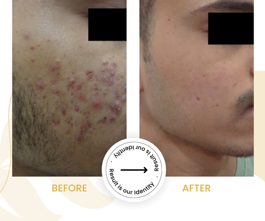 More even skin appearance