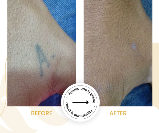 Improved skin appearance