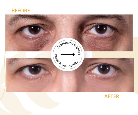 Brighter under-eye area