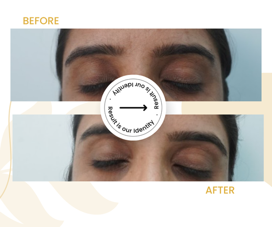 Improved skin texture